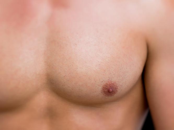 Male Breast Surgery